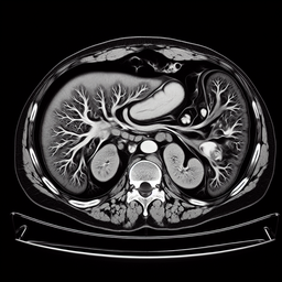 МРТ підшлункової залози