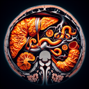 МРТ холангіографія